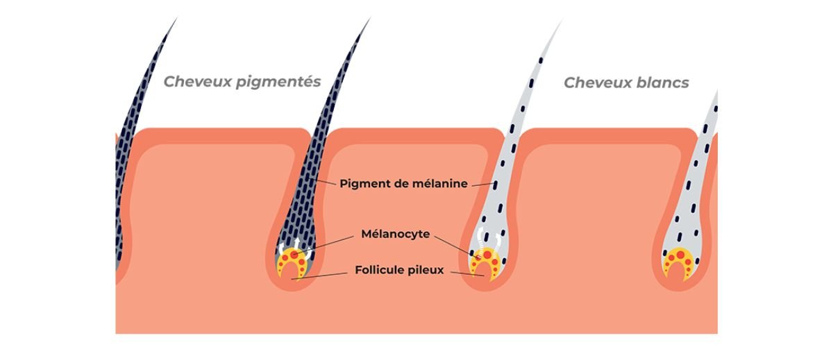 Pigmentation Cheveux Blancs